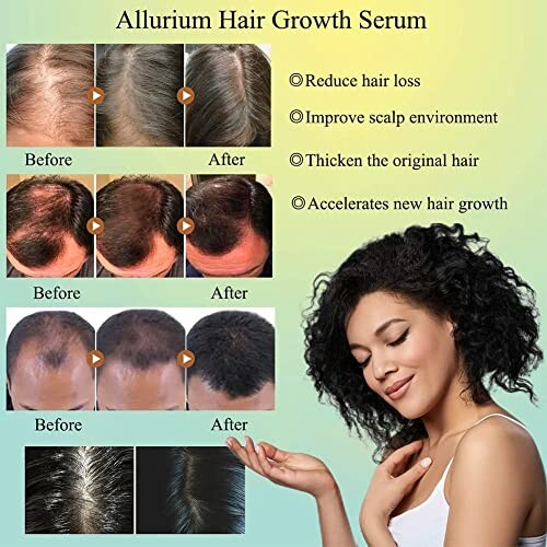 Allurium Hair Growth Serum before and after results with reduced hair loss and improved scalp.