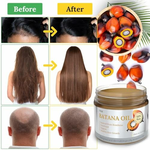 Before and after hair growth results using Batana oil.