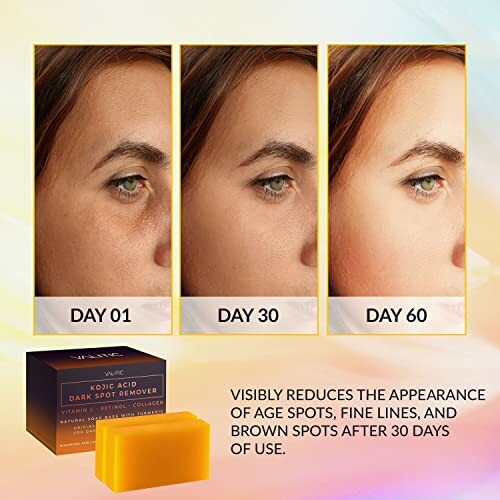 Comparison of skin improvement over 60 days using a dark spot remover.