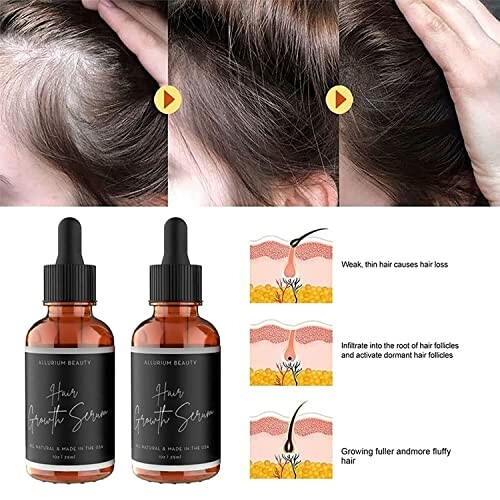 Hair growth serum with before and after results.