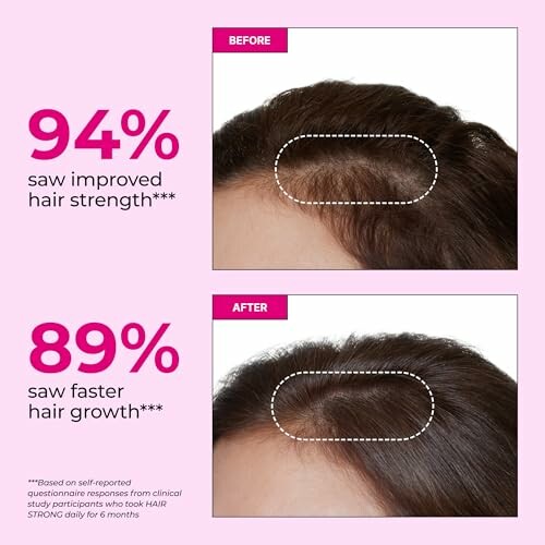 Before and after images showing improved hair strength and growth.