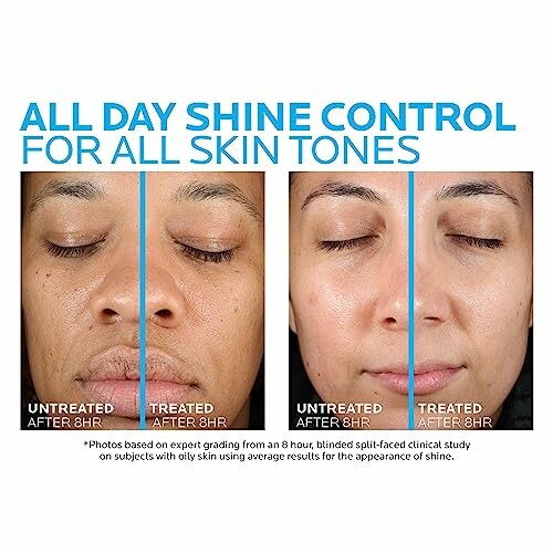 Comparison of untreated and treated skin after 8 hours showing shine control.