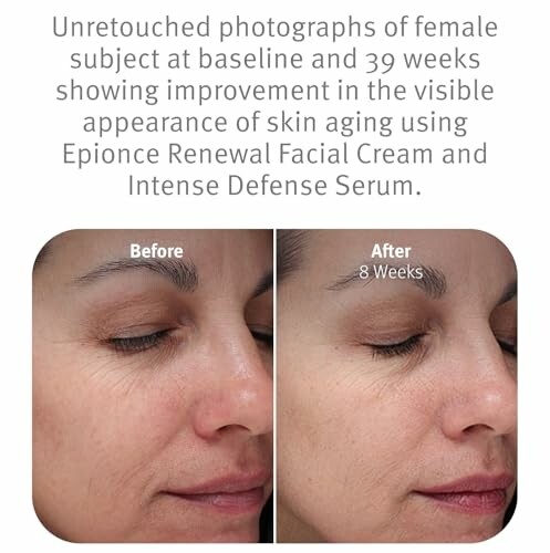 Comparison of skin before and after using skincare products for 8 weeks.