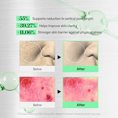 Before and after comparison of skin treatment effects.