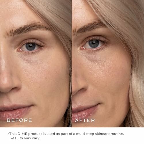 Before and after skincare product results on a woman's face.